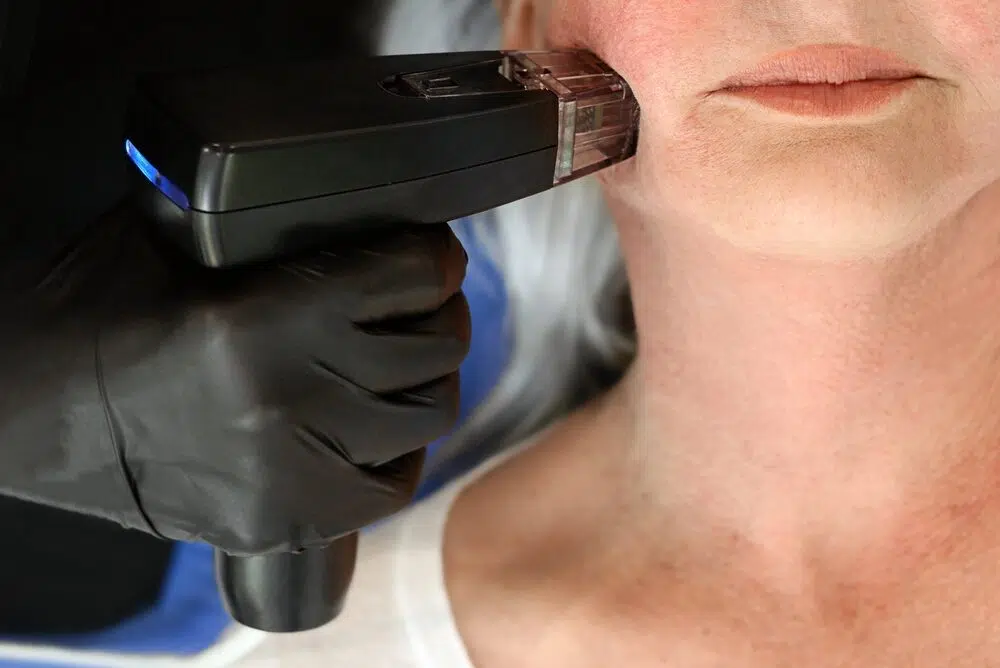 The Benefits of Morpheus 8 Resurfacing and Rejuvenation Treatment