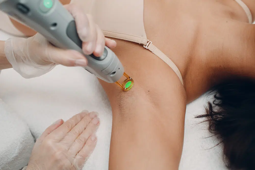 Is Laser Hair Removal Permanent? Dubai’s Este Clinic Delivers Permanent Results