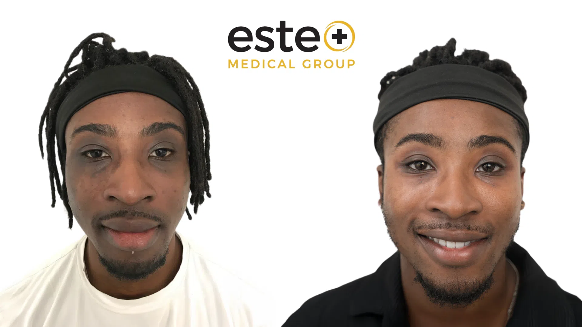 Pigmentation Life Changing Transformation