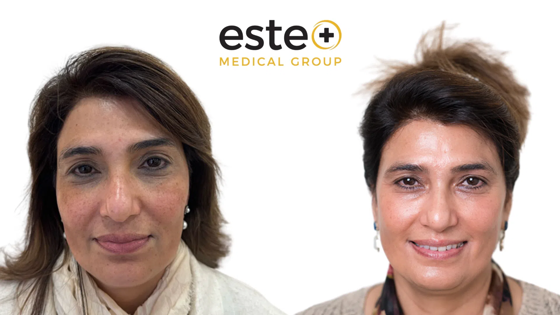 Pigmentation Life Changing Transformation After and Before Image