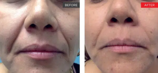 Life Changing Transformation Image