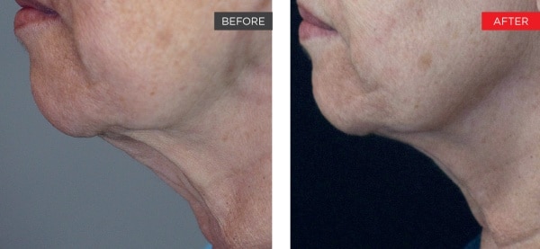 66fac81bc46f464094e15dae_courtesy_of_h_shiffman_md