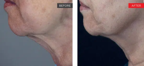 Life Changing Transformation Image