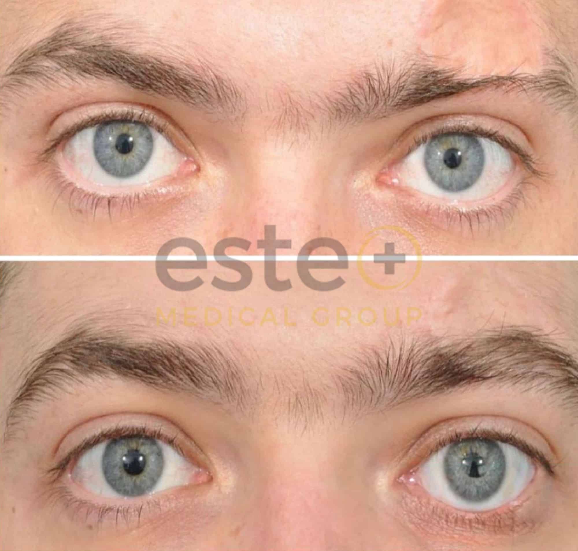 670f5f274e9bfff84a033c82_Edited Eyebrow-2-p-2000