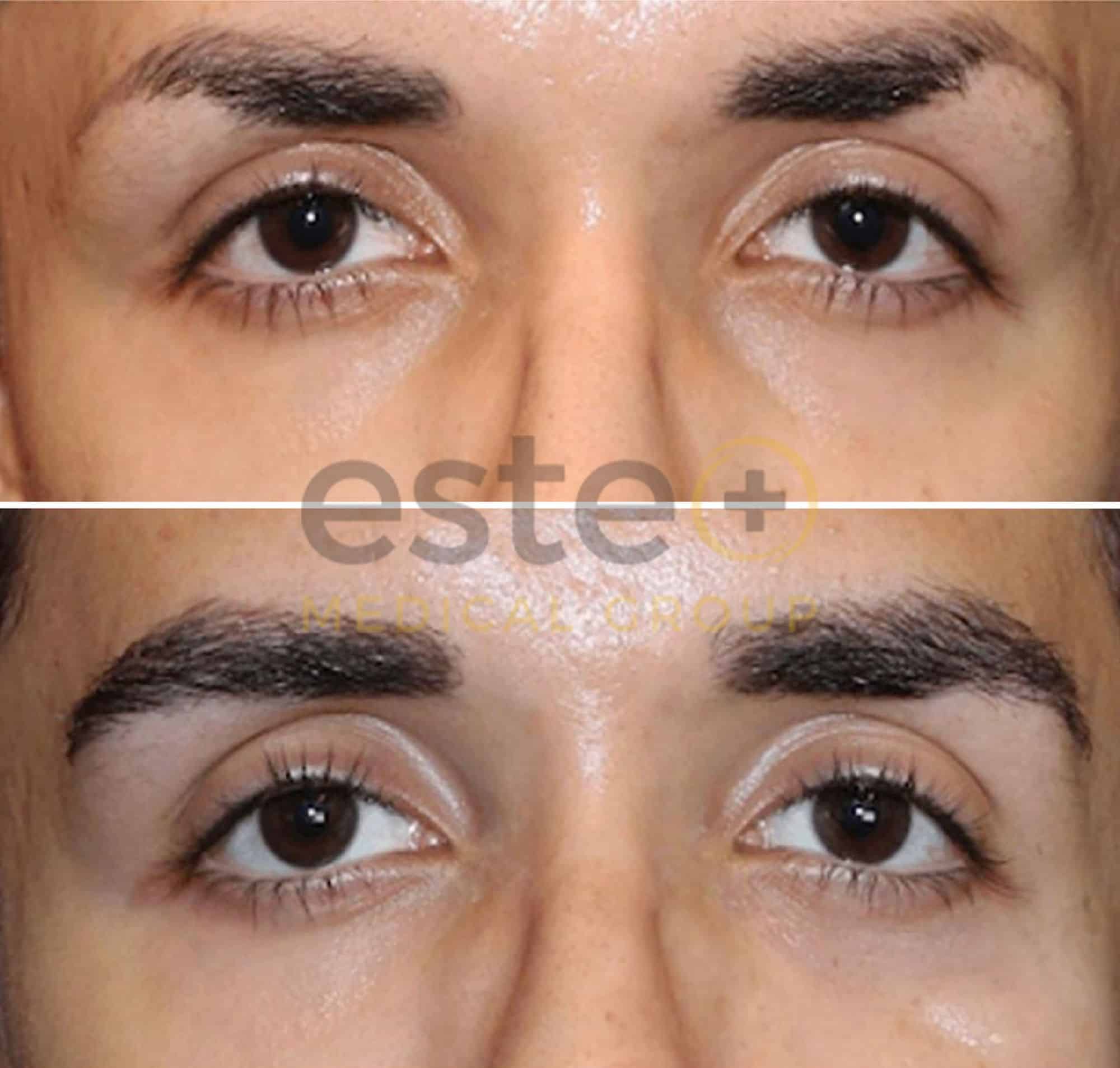 670f5f288b542ae7c7baae14_Edited Eyebrow-1-p-2000