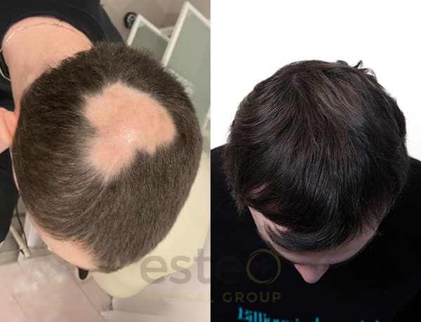 6799984be95719b8af67be3e_Unnamed_-Before-after-2
