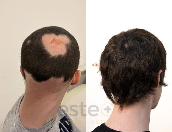 6799984bfc51c299bdeadc29_Unnamed_-Before-after-1