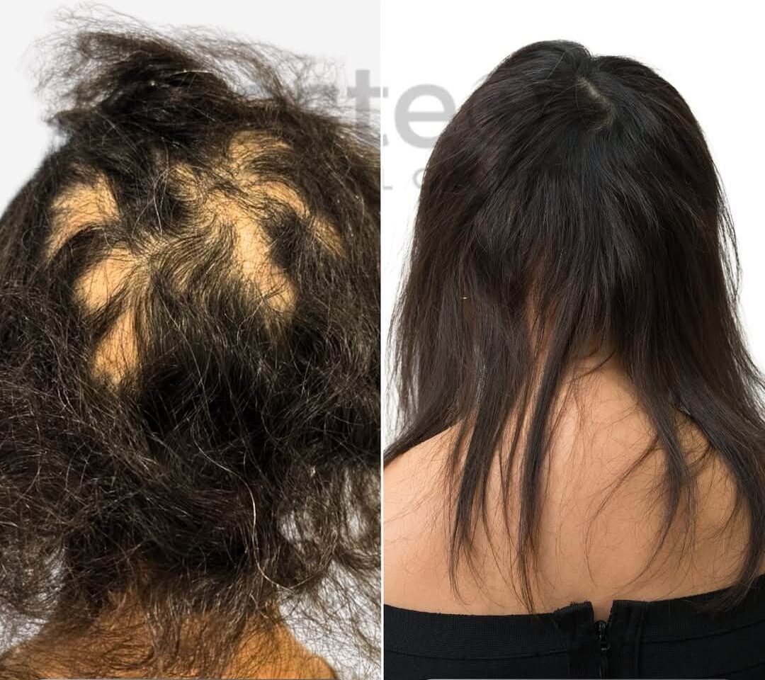 Before and After - Exciplex