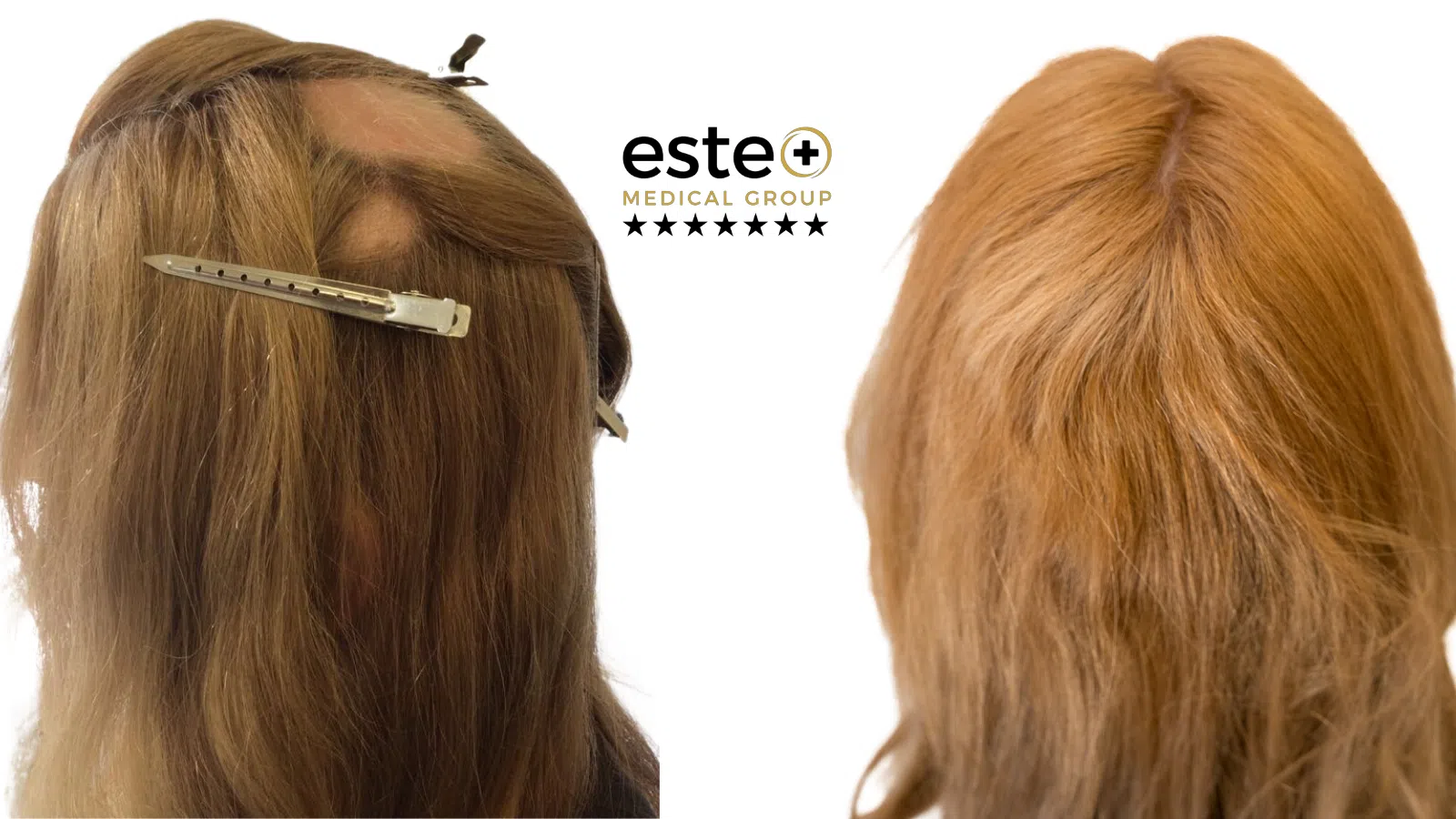 Pigmentation Life Changing Transformation After and Before Image