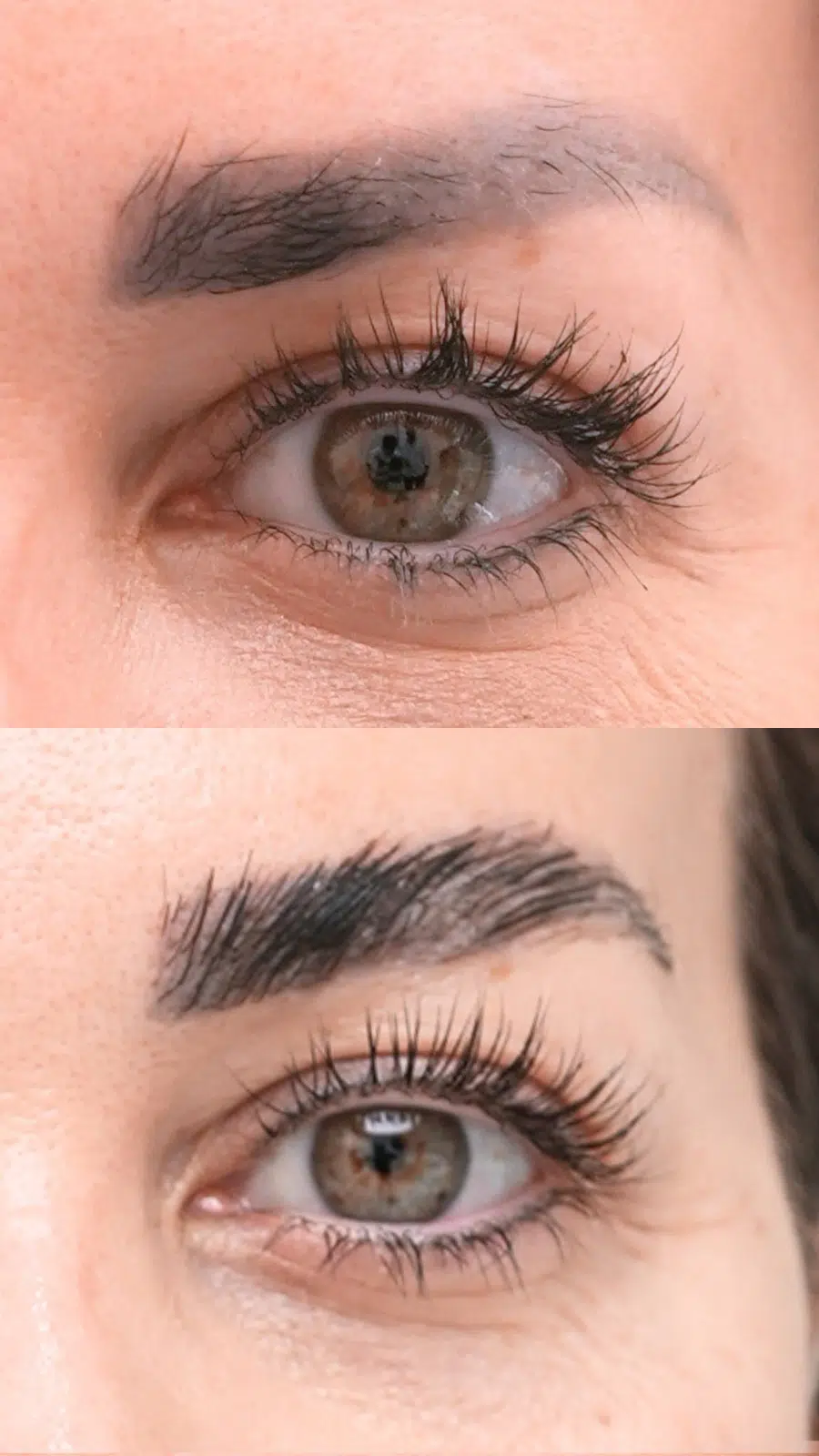 Eyebrow hair transplant results