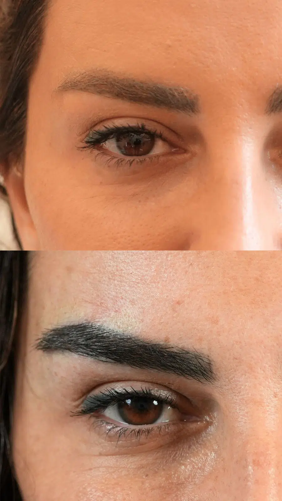 Eyebrow treatment results
